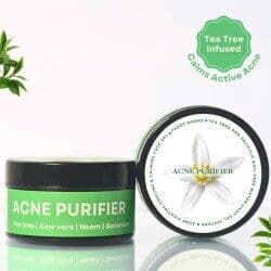 M&U Skin and Beauty Acne Purifier Face Gel